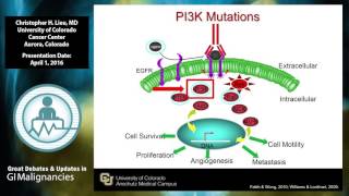 Biomarkers for treatment selection in colon cancer [upl. by Averill737]