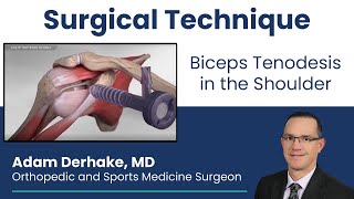 Biceps Tenodesis in the Shoulder Surgical Technique [upl. by Fates790]