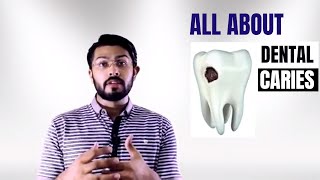 Dental Caries explained EASY [upl. by Anna]