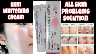 How to use skin light cream  skin light cream review  skin light cream sideeffects amp Benefits [upl. by Yentirb543]