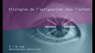 Etiologies de lastigmatisme chez lenfant [upl. by Ammej]