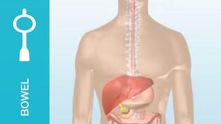 IRRITABLE BOWEL SYNDROME IBS  DIGESTION PROBLEM  CAUSE  SYMPTOMS  TREATMENT  in HINDI [upl. by Laurita898]