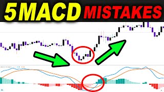 5 MACD Strategy MISTAKES you should avoid in Trading Forex Stocks or  Forex Day Trading [upl. by Severson622]