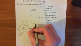 Strokes and Excitotoxicity Part 1 [upl. by Severn]