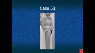 RADIOLOGY EXAM CASES [upl. by Sicular]