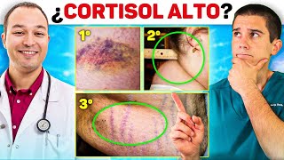 ASÍ afecta el CORTISOL ALTO a tu SALUD y PÉRDIDA DE GRASA Con Antonio Mas ENDOCRINO [upl. by Annahahs]