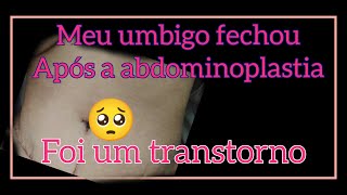 Meu umbigo fechou e agora umbigo abdominoplastia [upl. by Malorie643]