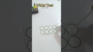 Widal test slide method shortvideo shotfeed viralshort [upl. by Ranique]