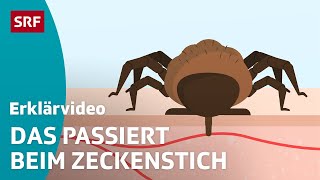 Zeckenstich amp übertragbare Krankheiten – einfach erklärt  Kindervideos  SRF Kids [upl. by Herrmann]