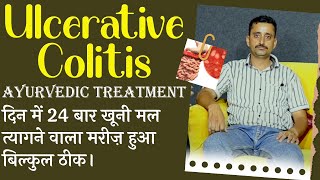 Ulcerative Colitis Ayurvedic Treatment दिन में 24 बार खूनी मल त्यागने वाला मरीज़ हुआ बिल्कुल ठीक। [upl. by Kip767]