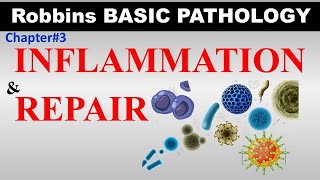 Chp3 Part1 Robbins Basic Patho  Inflammation amp Repair  PAMPs  DAMPs  Toll Like Receptors [upl. by Ahsito32]