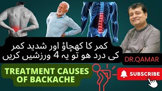 Treatment causes of backache  Dr Qamar [upl. by Quince]