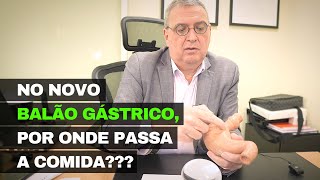 Novo BALÃO GÁSTRICO por onde passa a comida [upl. by Llenrap]