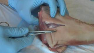 Suture  Basic Technique 1 [upl. by Edris]