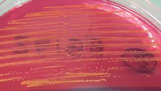 Leuconostoc mesenteroides growth on CLED agar of Urine Culture [upl. by Doerrer]