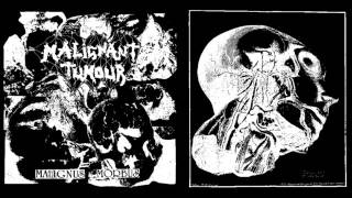 MALIGNANT TUMOUR  DECOMPOSED  Split 7quot 1995 [upl. by Nikki]