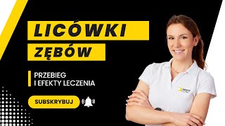 Licówki zębów Przebieg i efekty leczenia [upl. by Lietman968]