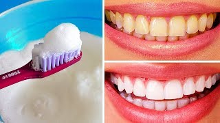 10 Natural Ways to Whiten Teeth at Home [upl. by Nitaf301]