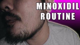 Minoxidil for Beard Growth Week 15 My Minoxidil Routine [upl. by Nosyla]