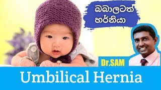 බබාලටත් හර්නියා Umbilical Hernia sinhala [upl. by Kirsten]