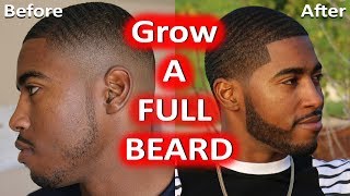 How To Grow a Thicker Full Beard  No Patches Fast [upl. by Aihseken]