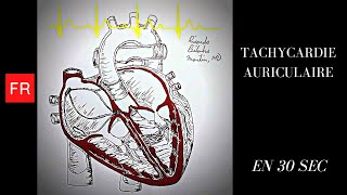 Arythmies animation cardiaque et ECG  Tachycardie auriculaire Shorts [upl. by Ammeg]