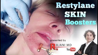 Restylane Skin Boosters [upl. by Hardigg546]