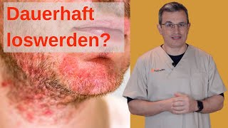 OFT nervig SELTEN schlechtes Omen Seborrhoische Dermatitis Achtung ausführliches Video [upl. by Aileon]