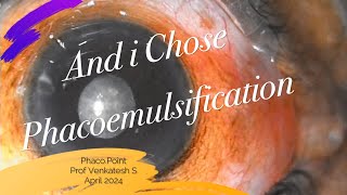 AND I CHOSE PHACOEMULSIFICATION  Hard cat with non dilating pupil [upl. by Ggerg]