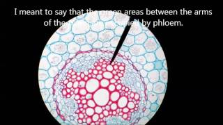 microscopic ranunculus dicot root cross section anatomy darrellbarnes darrelldbarnes [upl. by Fitts421]