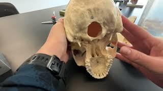 Skull Frontal Parietal and Occipital Bone and their bone markings [upl. by Verdie]