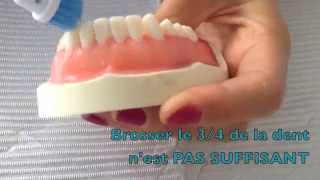 Technique de brossage des dents avec brosse  à dent électrique – Dr Rania Azzi Parodontiste [upl. by Howie610]