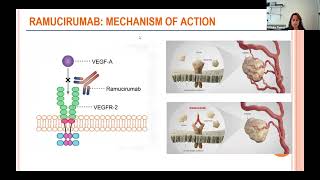 Clinical Trials for Thymic Tumors 2024 Update [upl. by Anaizit]