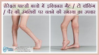 Treatment of Equinus gait toe walking walking on toes in cerebral palsy treatment at Trishla [upl. by Aural]