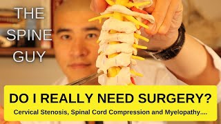 Cervical Stenosis Spinal Cord Compression and Myelopathy DO I REALLY NEED SURGERY [upl. by Mayman]