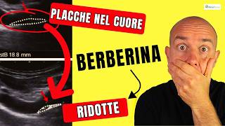 Questo CONTROVERSO SUPPLEMENTO riduce le PLACCHE nelle ARTERIE  BERBERINA [upl. by Desma567]