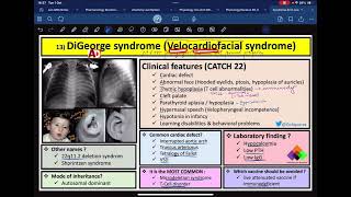 Easiest way to remember DI GEORGE SYNDROME  Pathology  NEETPG INICET FMGE [upl. by Gosser]