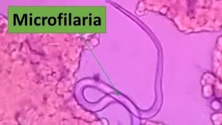 Microfilariae at wet MountRed blood cellsUnder microscope [upl. by Geier]