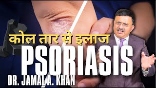 Psoriasis Causes Triggers and Treatments  Dr Jamal A Khan [upl. by Rokach]