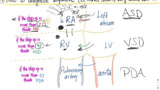 How to diagnose acyanotic heart diseases Left to Right shunt via Cardiac Catheterization [upl. by Aubigny301]