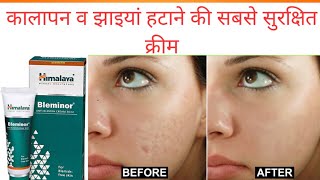 Bleminor anti blemish cream review in Hindi  झाइयां हटाए रंग निखारे [upl. by Arotahs91]