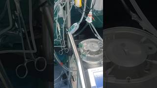 ECMO Machine Open heart surgery surgeon travel heartsurgerysurvivor ecmo [upl. by Lucic]