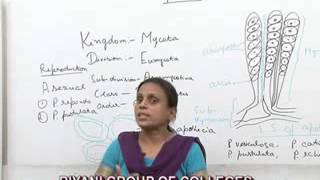 Peziza Lecture BSC Botany by Dr Anupama Goyal [upl. by Liuka]