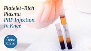 PlateletRich Plasma  PRP Injection In Knee for Knee Pain amp Arthritis [upl. by Boycey]