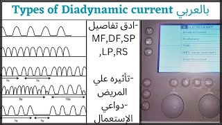 Types of diadynamic current بالعربيFixed monophasediphaseshort periodlong periodsyncopal rhythm [upl. by Elenahc]