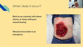 Postoperative complications Part 2 [upl. by Relyc]