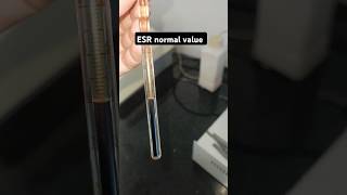 ESR Erythrocyte Sedimentation rate 🩸🩸🧑‍🔬💉blood infectionTest normal valueamp result status shorts [upl. by Tedie]