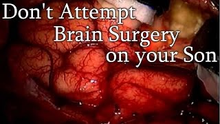 quotDont Attempt Brain Surgery on your Sonquot Creepypasta [upl. by Ardiedal]