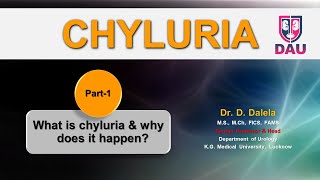 CHYLURIA  What is chyluria amp why does it happen [upl. by Chery]