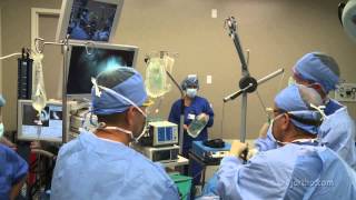 Shoulder Surgery Arthroscopy OR Setup and Patient Positioning [upl. by Melc]